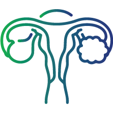 Poly Cystic Ovarian Syndrome (PCOS)