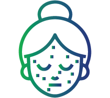 Skin rash (a butterfly rash) across your cheeks