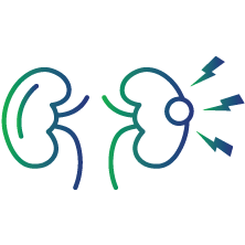 Monitor immune complex-related conditions such as glomerulonephritis (GN)