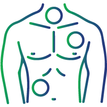 Check if cancer has grown or spread (metastasized) to other body parts
