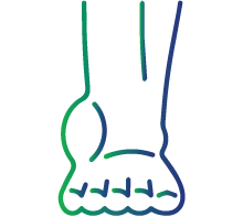 Painful, swollen bruises