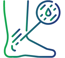 Easy bruising or bleeding