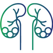 Kidney stones