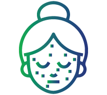 Skin rash (a butterfly rash)