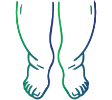 Swelling in your abdomen, feet, legs