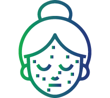 Skin rash (a butterfly rash)