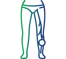 Blood clots in veins and arteries