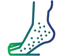 Autoimmune vasculitis (Inflammation of blood vessels)