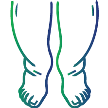 Swelling in the legs and ankles