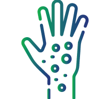 Symptoms related to cyst rupture, such as severe allergic reactions or anaphylaxis