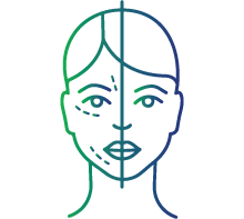 Drooping on both sides of the face