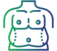 Increased fat deposits, especially in the abdomen