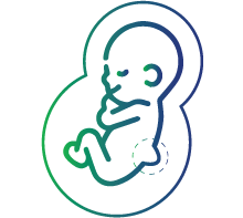 Open neural tube defects, such as spina bifida