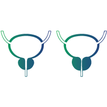 Benign Prostatic Hyperplasia which is a non-cancerous enlargement of the prostate gland
