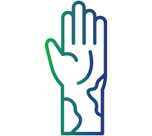 Livedo reticularis (mottled skin discoloration)