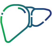 Hepatomegaly (enlarged liver)