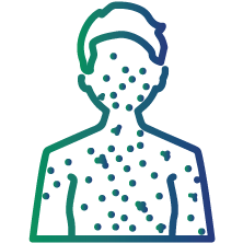 To confirm measles in individuals who have suspected symptoms or have been exposed to people with active infections