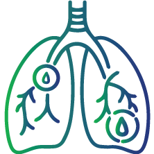Rapid onset of pulmonary haemorrhage