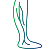 Deep vein thrombosis (DVT): Leg swelling, pain, redness, and warmth.
