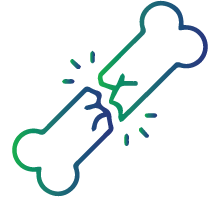 Frequent fractures (hip, wrist, spine) from minor falls or even coughing