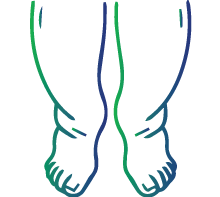 Swelling of the body (legs, abdomen)