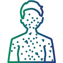 To determine the current, ongoing measle infection in individuals who have never been vaccinated
