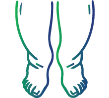 Swelling of feet and ankles