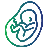 Trisomy 18 (Edward’s syndrome)