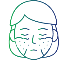 Sjogren's syndrome (Exocrine glands)