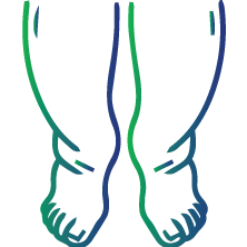 Swelling in your arms or legs