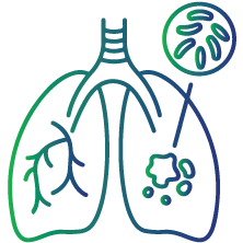 To find people with latent TB infection who may have been exposed to someone diagnosed with an active TB disease