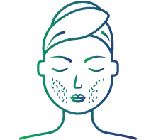 Excessive facial or body hair (hirsutism) in women