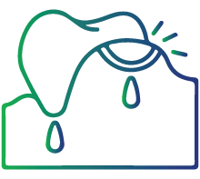 Gingival hyperplasia (gum overgrowth)