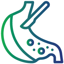 Gastric by-pass surgery