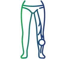 Unexplained deep vein thrombosis (DVT) or pulmonary embolism (PE)