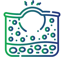Ulceration or nodules