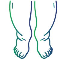 Persistent swelling, pain, or tenderness in one leg