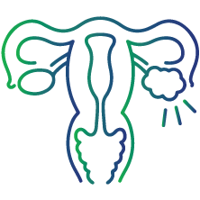 Polycystic Ovary Syndrome (PCOS)