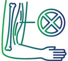 Upon the development of symptoms indicative of neuromuscular diseases, such as weakness in the muscles