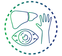 Jaundice (yellowing of the skin and eyes)