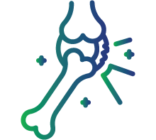 Joint stiffness