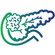 Pancreatic cancer