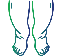 Pain and swelling due to the thrombotic episodes