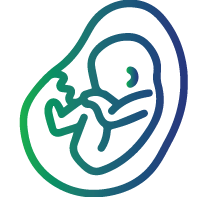 Trisomy 18 (Edwards syndrome)