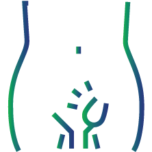 Mucopolysaccharidosis type I: Babies may have a soft protruding part around the belly-button (umbilical hernia) or lower abdomen (inguinal hernia)