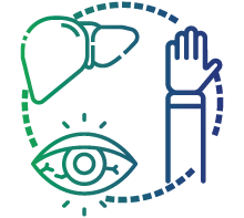 Jaundice  (yellowing of skin and eye white)