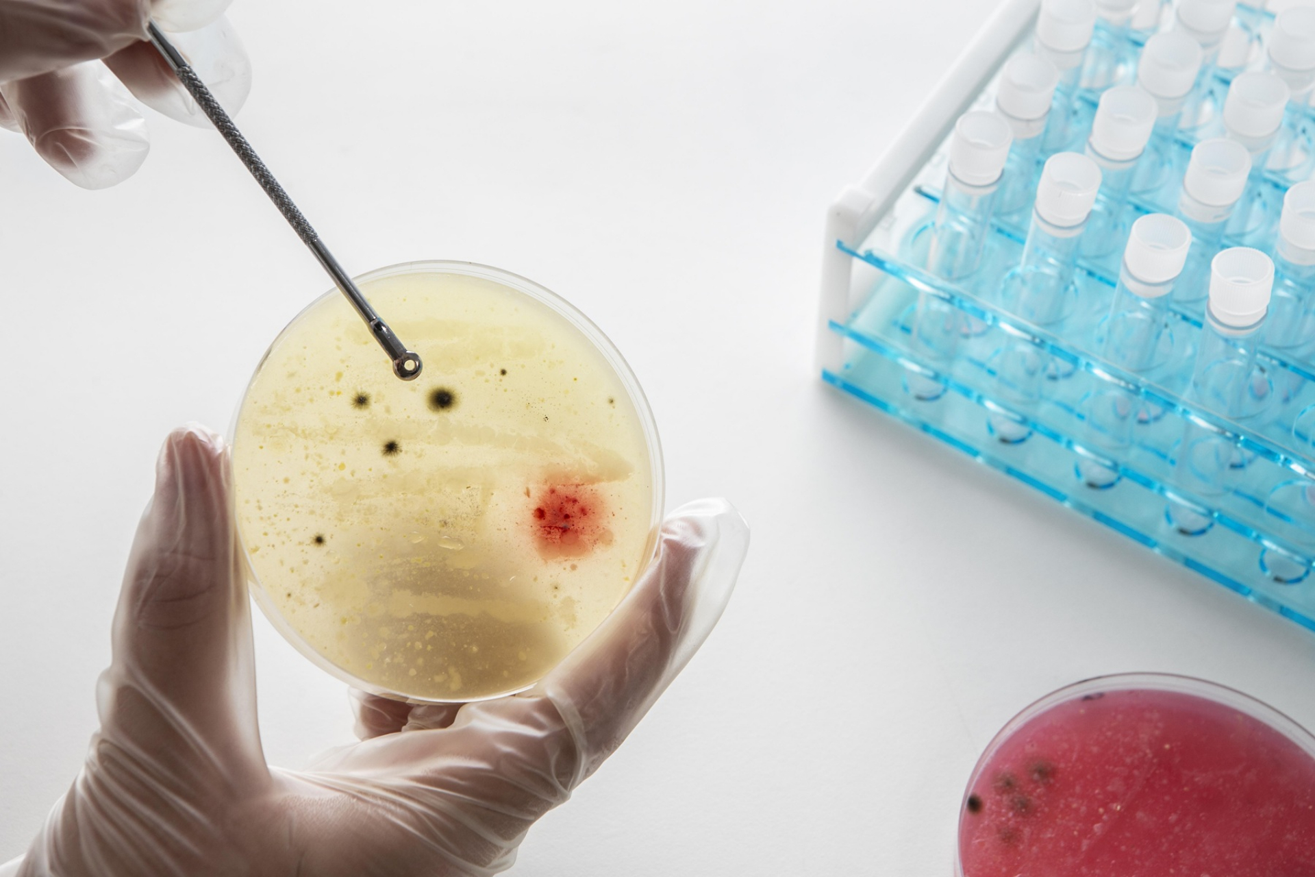 how-a-urine-culture-and-sensitivity-test-helps-diagnose-infections
