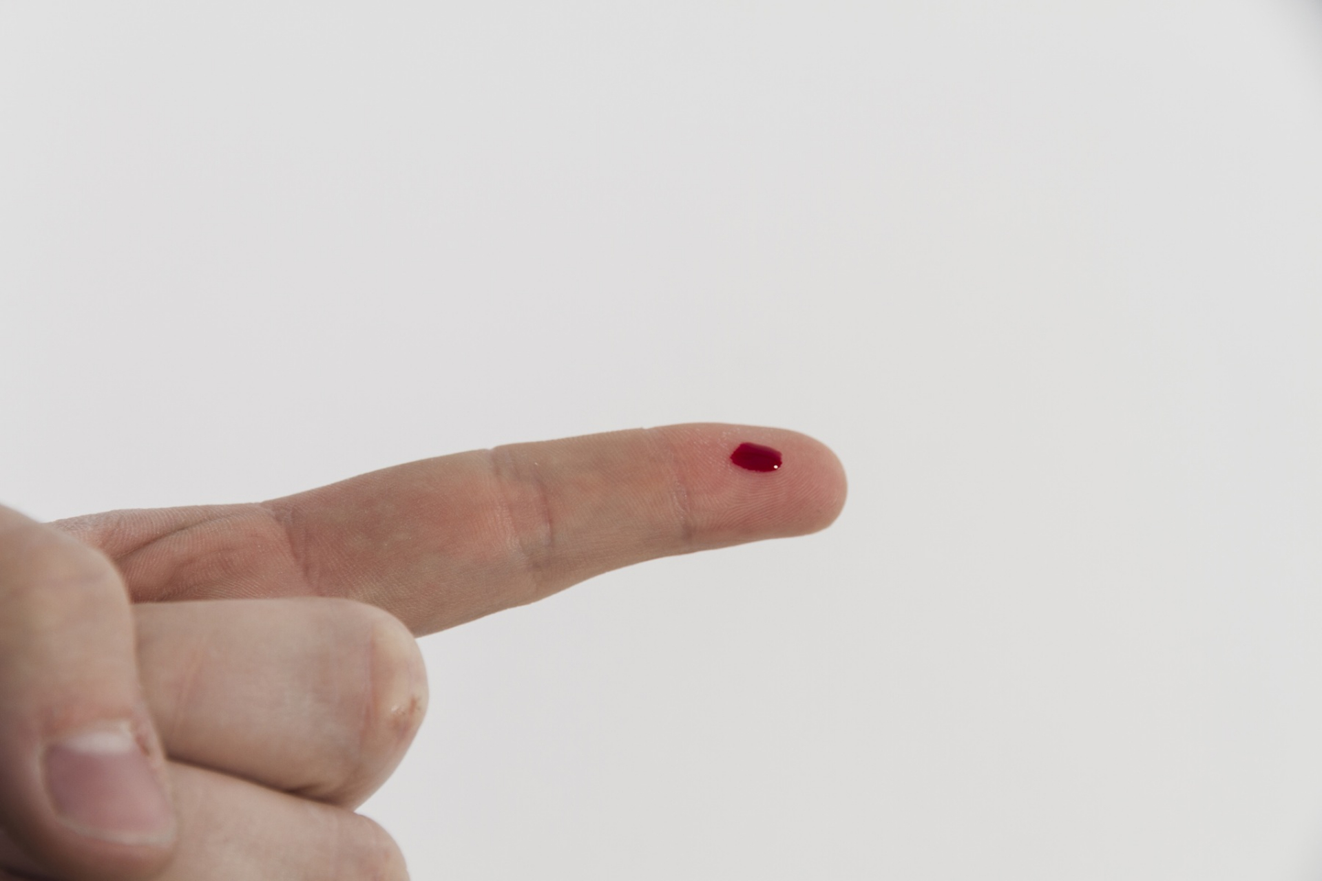 protein-c-activity-normal-range-in-blood-test-explained