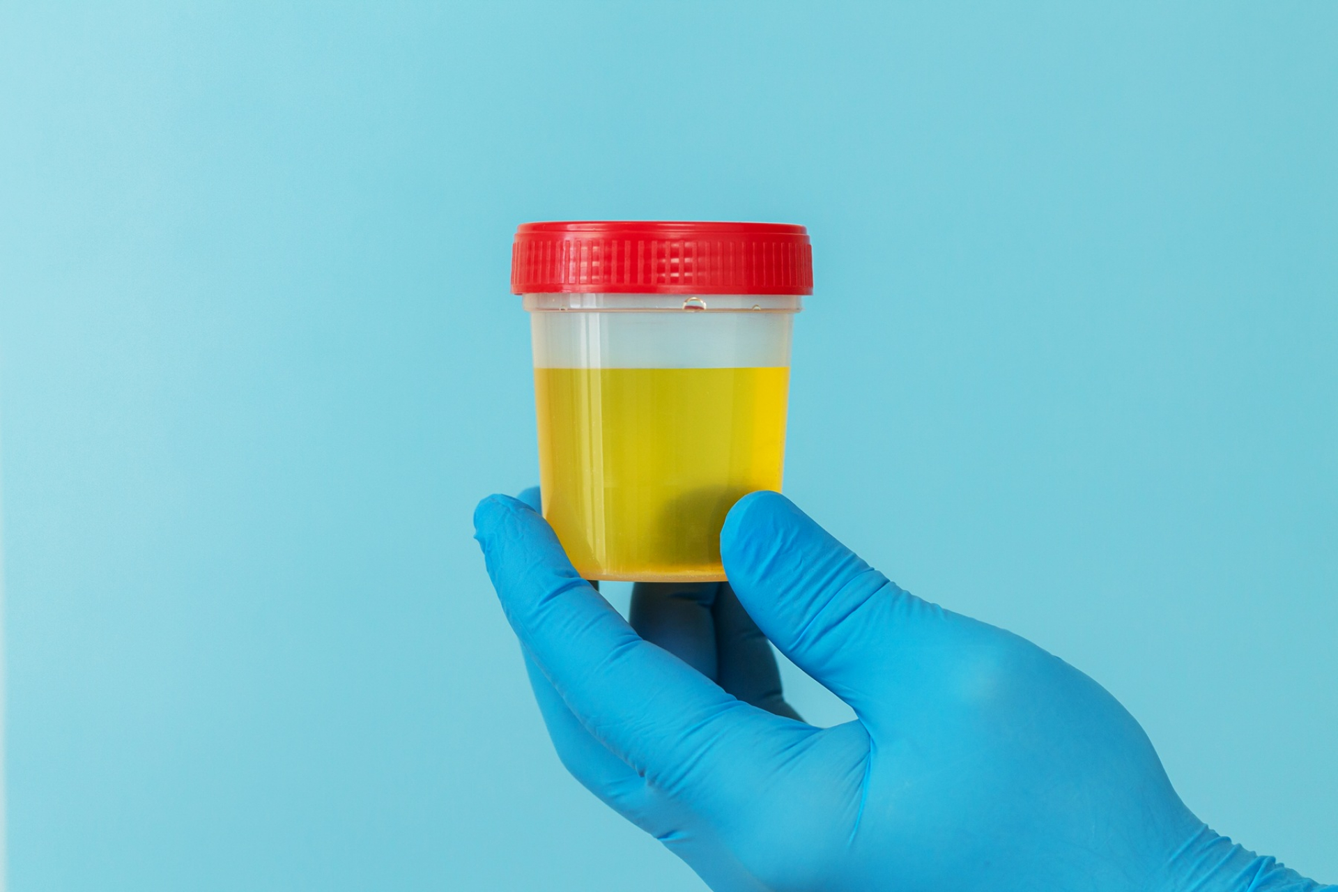 explaining-normal-sugar-levels-in-urine-and-fasting-glucose-test-results