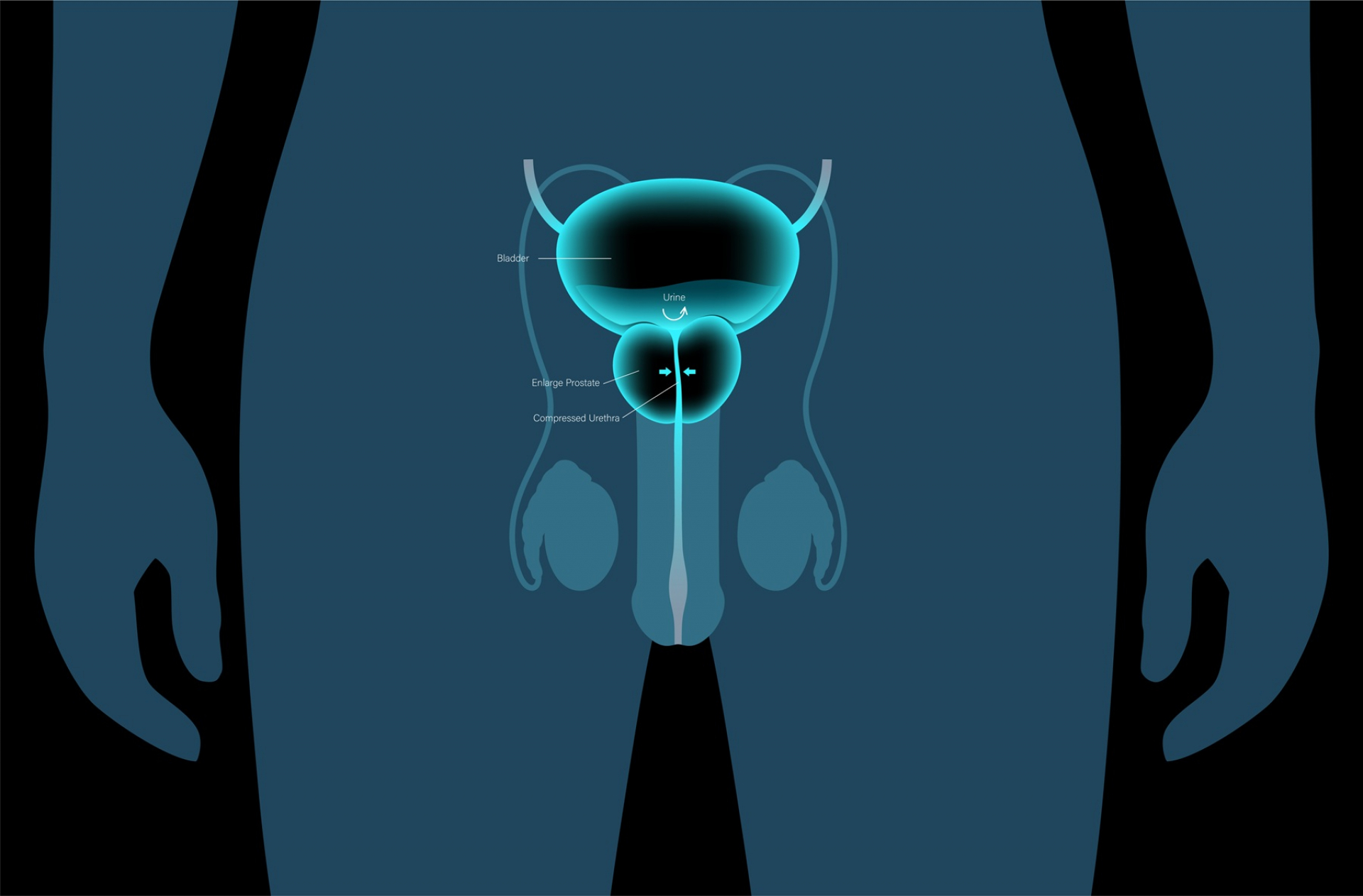 understanding-psa-levels-in-prostate-cancer-what-you-should-know